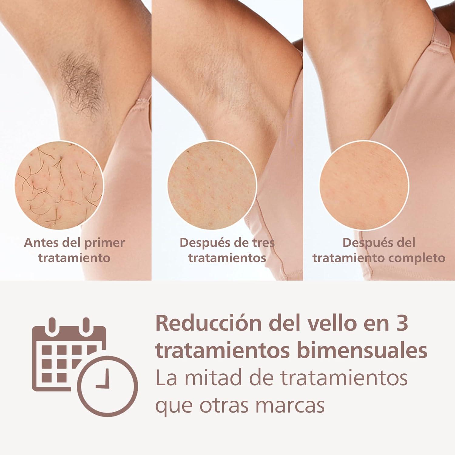 Philips IPL Hair Removal Device BRI958/00 – Pink